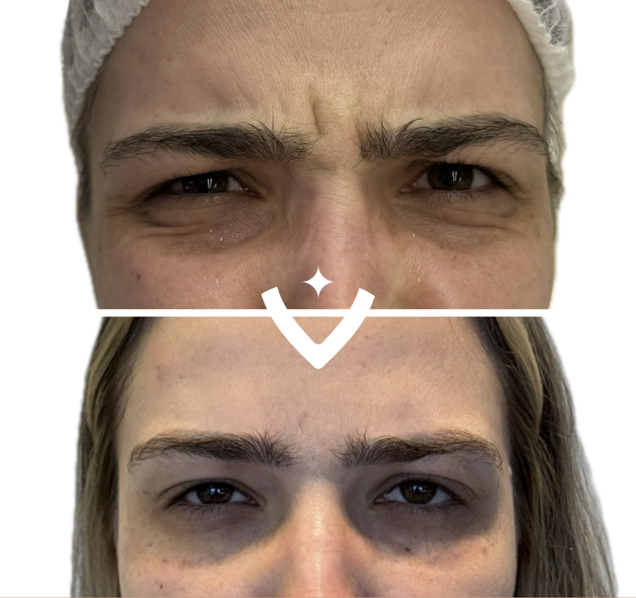 Antes e depois de tratamento dermatológico 5
