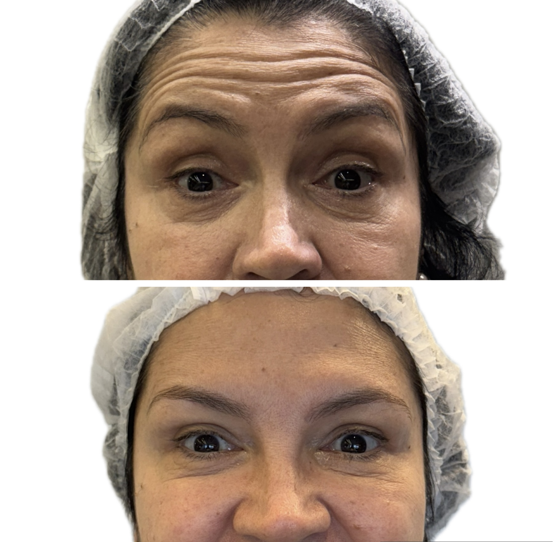 Antes e depois de tratamento dermatológico 1